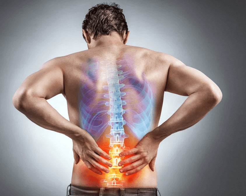 Understanding Sciatic Nerve Pain and How to Prevent It